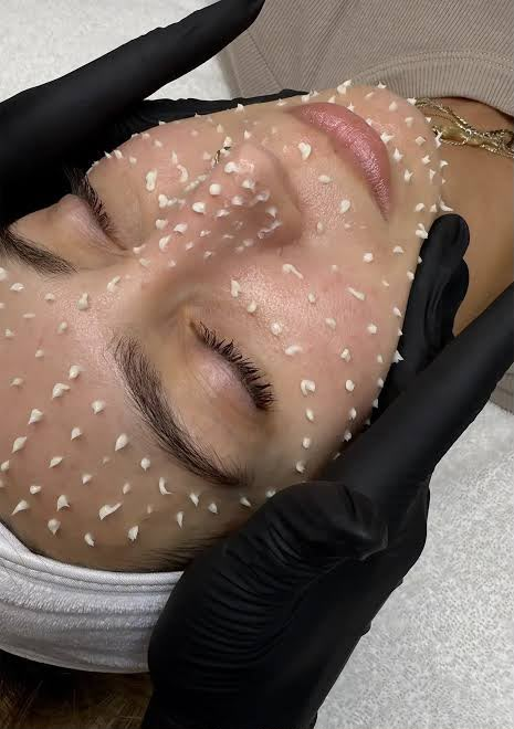 Estética Regenerativa